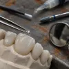 Tooth gem: a joia no dente que virou febre em 2026 e o que ninguém conta sobre esmalte, durabilidade e remoção